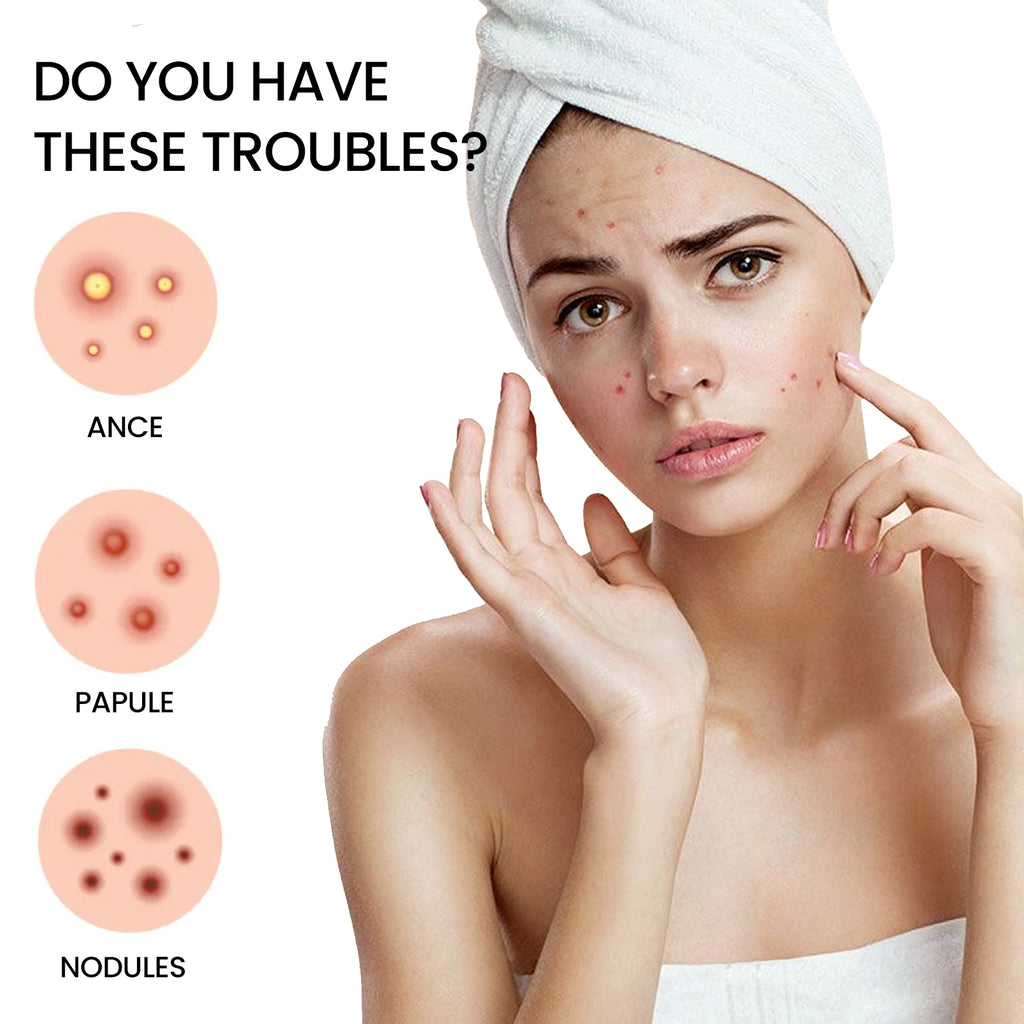 Jaysuing Star Colored Acne Stickers Repair Acne Pits & Marks Fade Acne Spots Blemishes Cover Acne Pimples